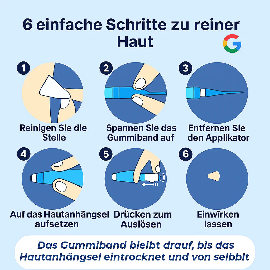 TagBuddy Kit – Keine Hautanhängsel mehr