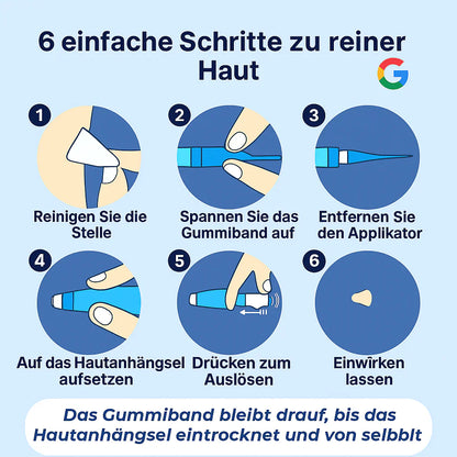 TagBuddy Kit – Keine Hautanhängsel mehr